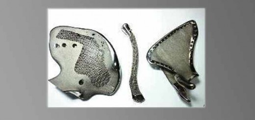 3d printing bone 1