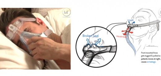 metamason-3d-printed-CPAP-masks-2