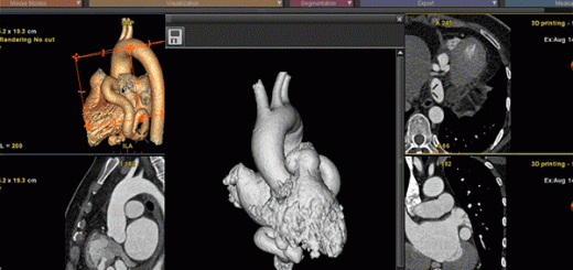 ge healthcare_1